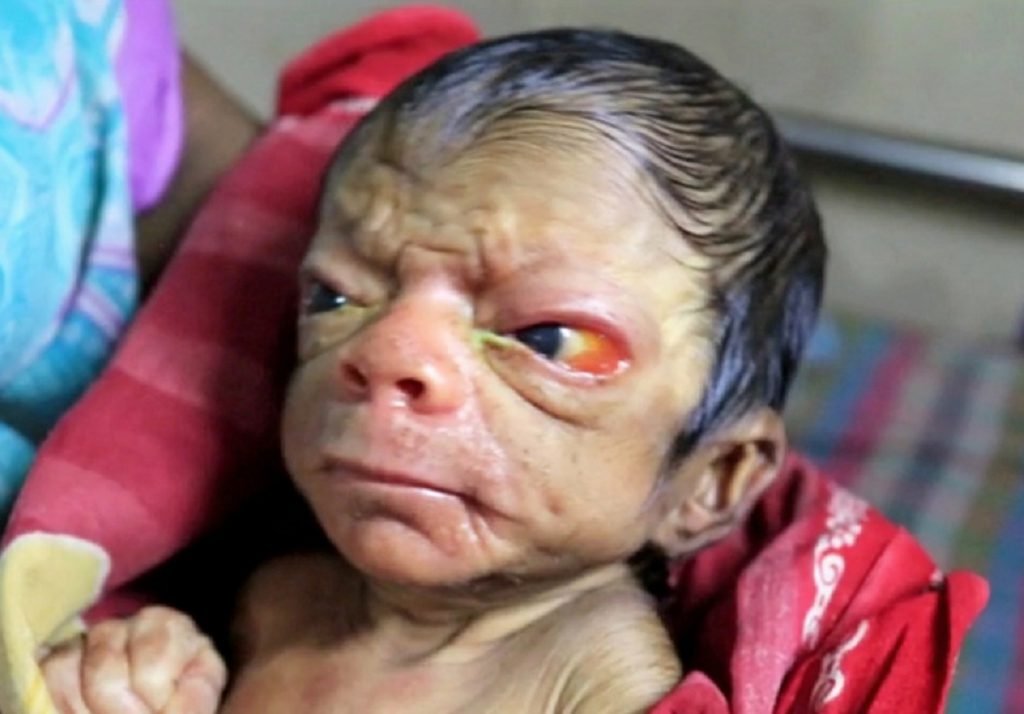 Un bebeluș s-a născut cu o afecțiune rară: „Nu arată deloc precum un nou-născut”