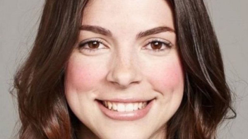 A plecat la plajă dar a uitat să se dea cu cremă pe faţă şi a stat în soare toată ziua. Iată cum a ajuns să arate