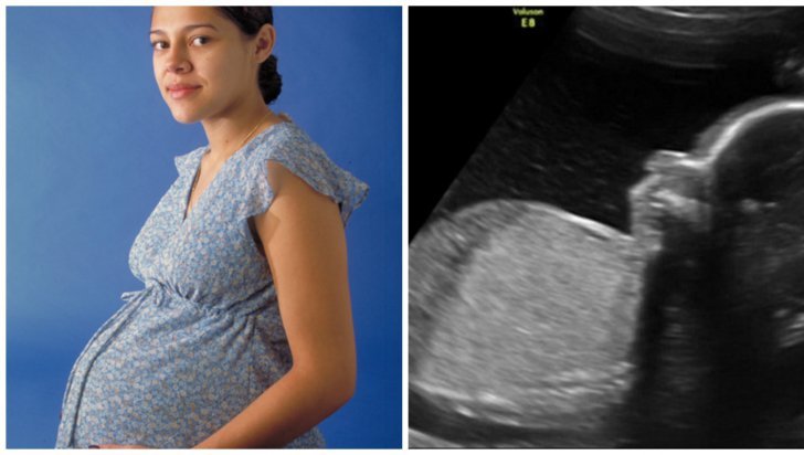 Întâi a aflat că e însărcinată, apoi a primit vestea: 