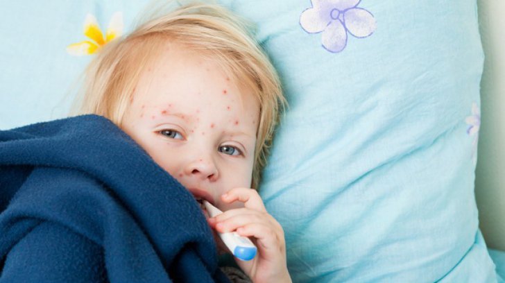 Epidemia de rujeolă face încă o victimă - a murit un copil de doi ani. Bilanţul a ajuns la 25