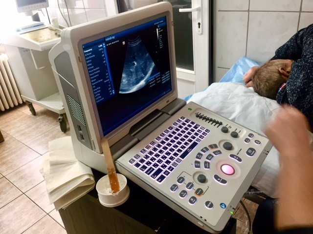 Primăria Municipiului Arad a dotat Compartimentul Nefrologie, din cadrul Spitalului Clinic Județean de Urgență Arad cu un ultrasonograf