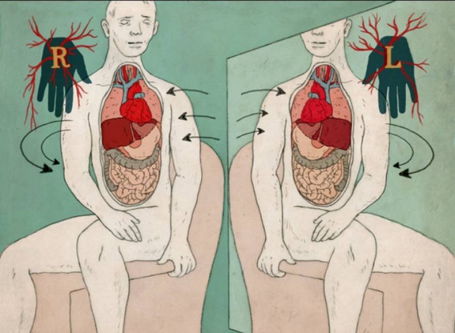  Boală ciudată: organe în oglindă 