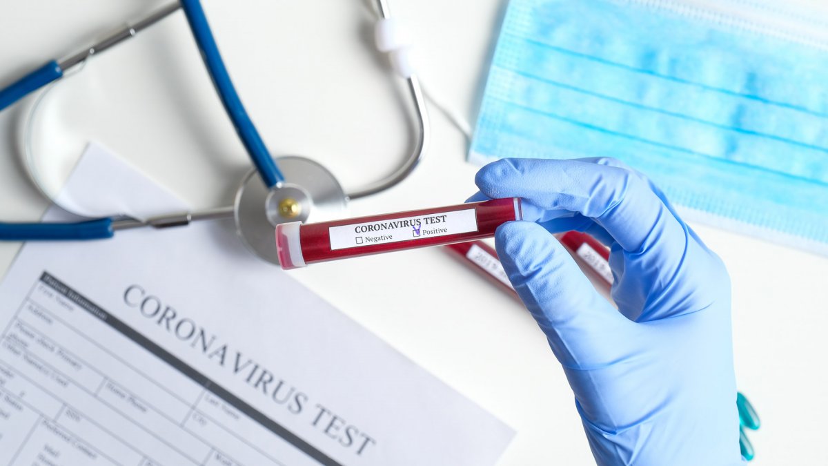 România raportează 392 decese provocate de coronavirus