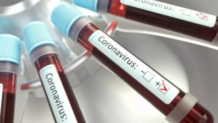 MAE: 28 de cetățeni români aflați la muncă în Olanda, confirmați pozitiv cu coronavirus