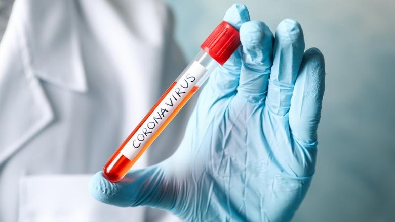 Coronavirusul face alte 14 victime printre care şi un arădean