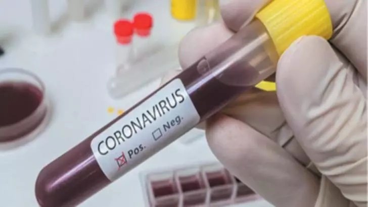 STUDIU: Imunitatea la Covid-19 ar putea dura doar câteva luni