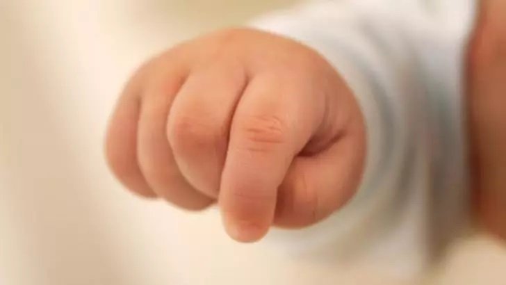 Caz șocant în București: bebeluș cu două capete, născut viu. Mama știa de malformație