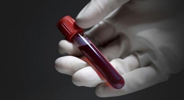S-a descoperit misterul grupelor de sânge extrem de rare cu RH negativ!