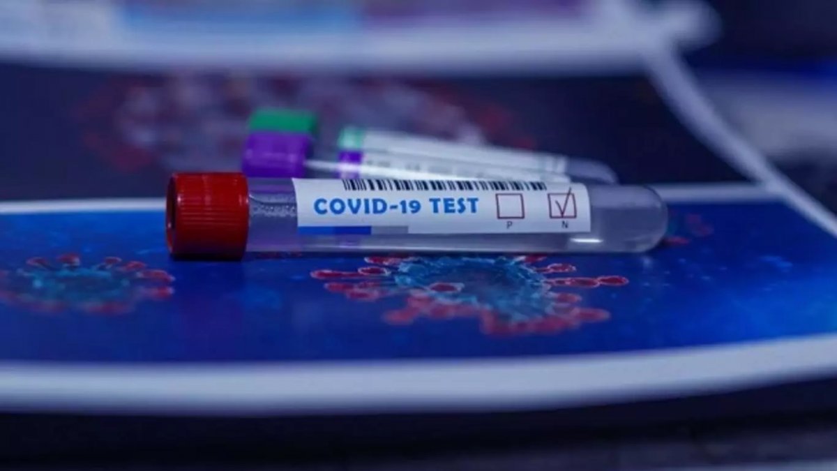Studiu: Testele rapide antigen nu depistează decât jumătate din cazurile detectate cu teste RT-PCR