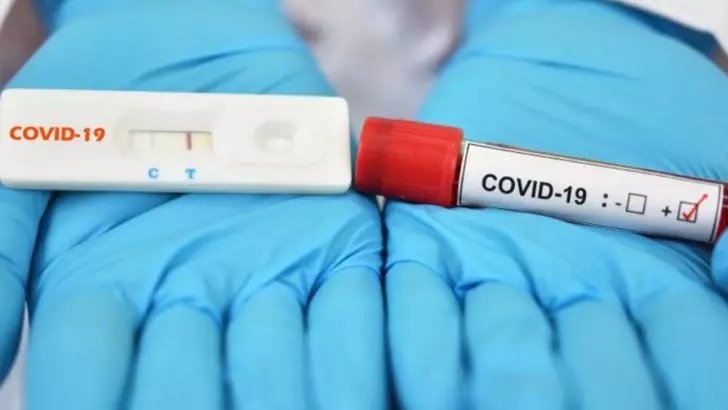 Toți angajații nevaccinați trebuie să se testeze săptămânal pentru Covid, contra cost. Ce țară din europa a luat decizia