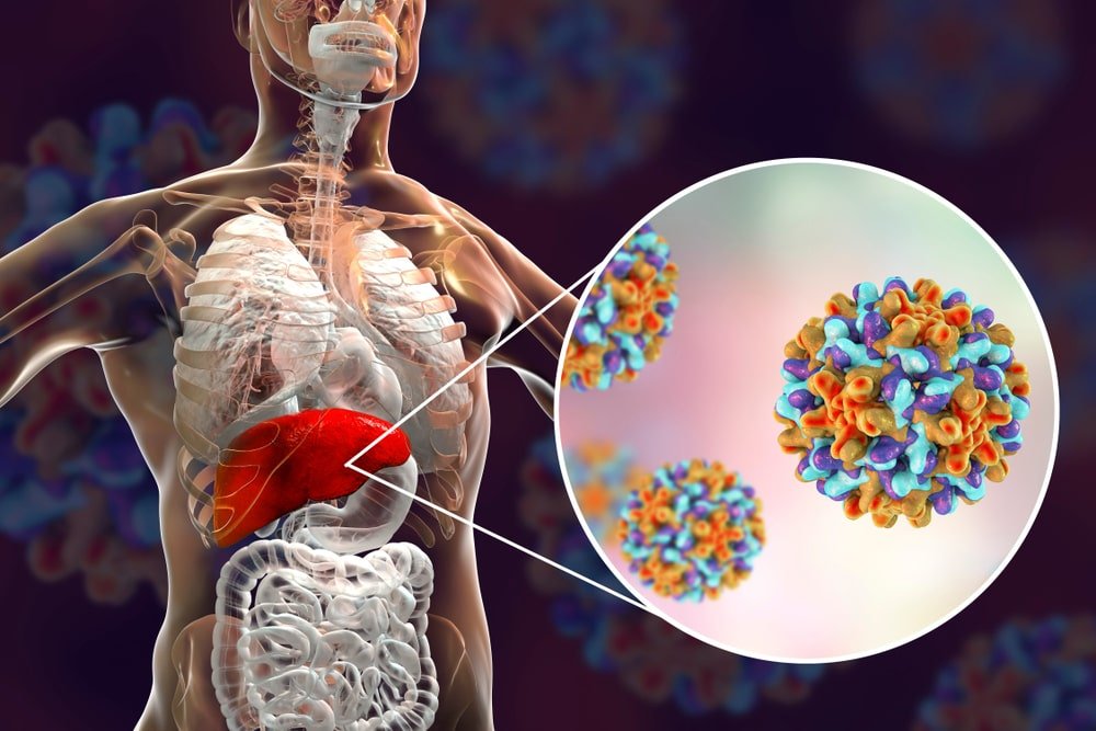 Ficat mărit: ce boli grave ascunde hepatomegalia?