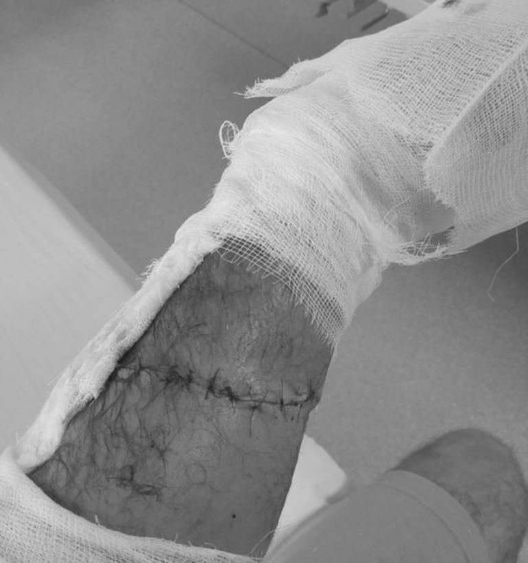 Accident casnic soldat cu o tăietură foarte urâtă; vezi ce s-a întâmplat apoi la spital