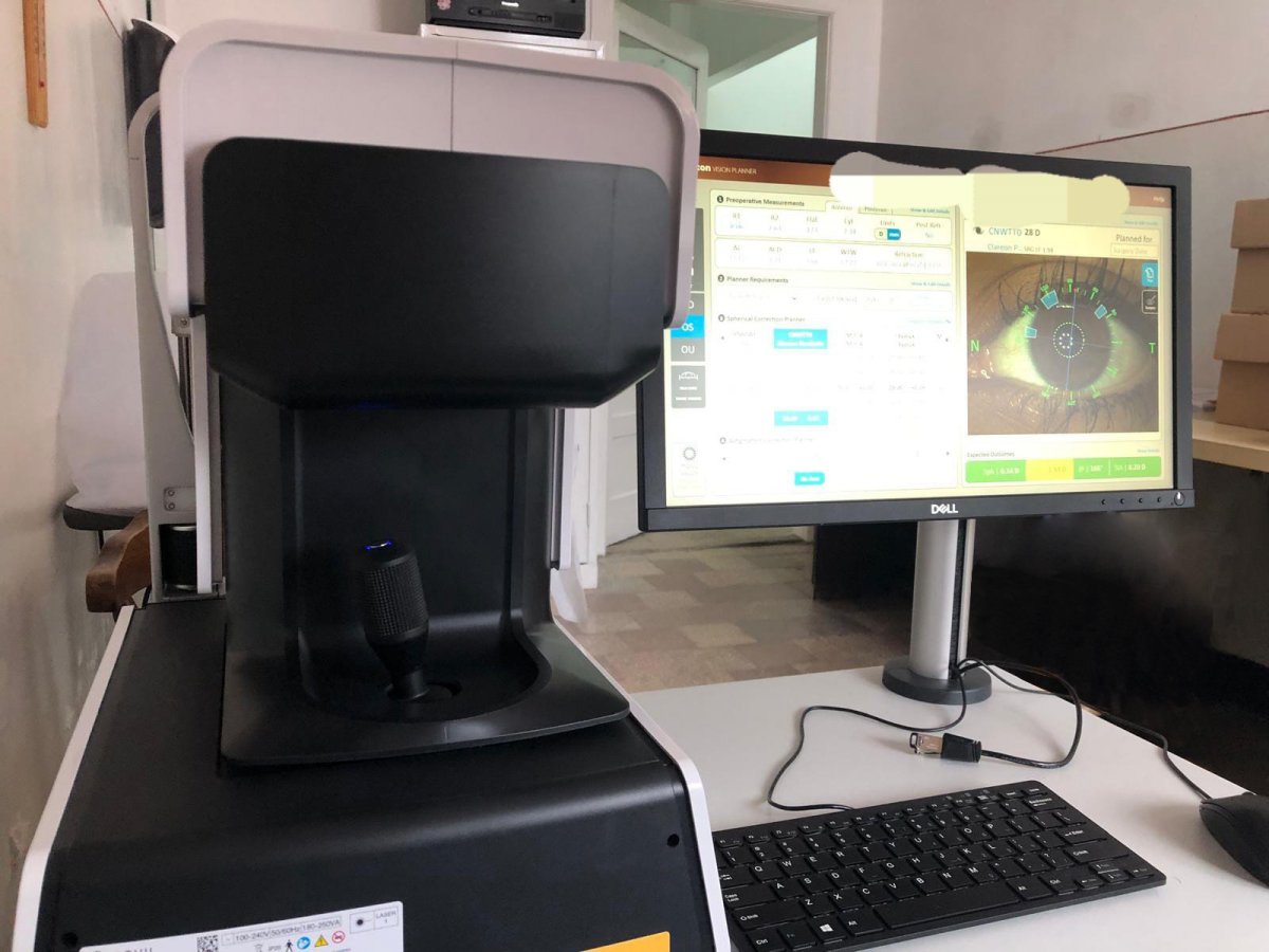 Operații de cataractă pregătite cu maximă acuratețe – biometru optic de ultimă generație la Oftalmologie