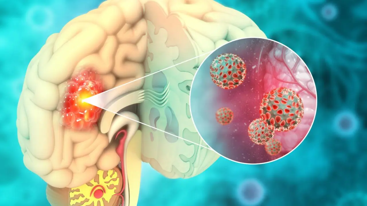 Descoperire vitală în medicină. Un simplu test de sânge ar putea detecta cancerul cerebral. Ce susțin oamenii de știință