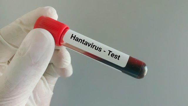 Franța a emis un decret de izolare pentru persoanele suspectate de infectare cu hantavirus