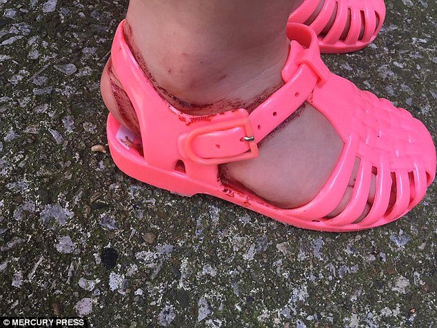 Groaza trăită de o mamă după ce i-a făcut fetiței ei cadou o pereche de sandale, după doar o oră